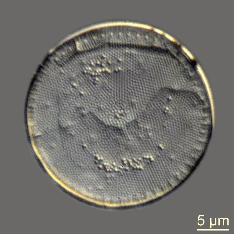 Thalassiosira #44648