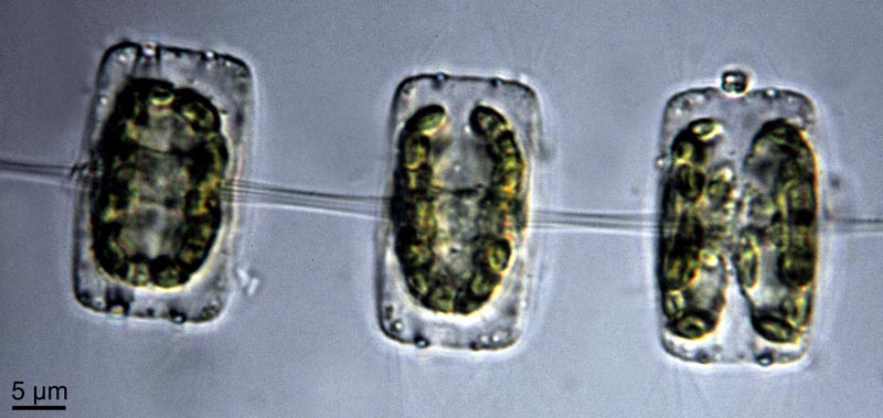 Thalassiosira spp. #36994