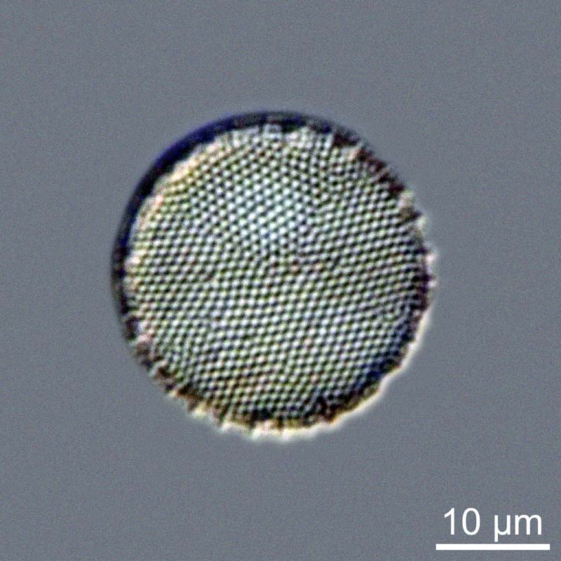Thalassiosira spp. #47511