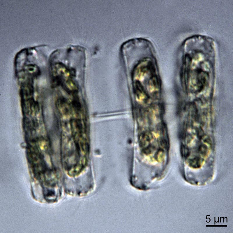 Thalassiosira spp. #36995