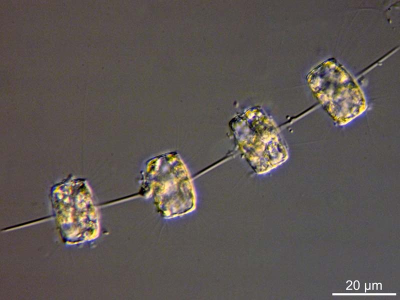 Thalassiosira spp. #47510