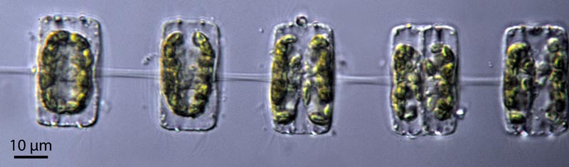 Thalassiosira spp. #36993