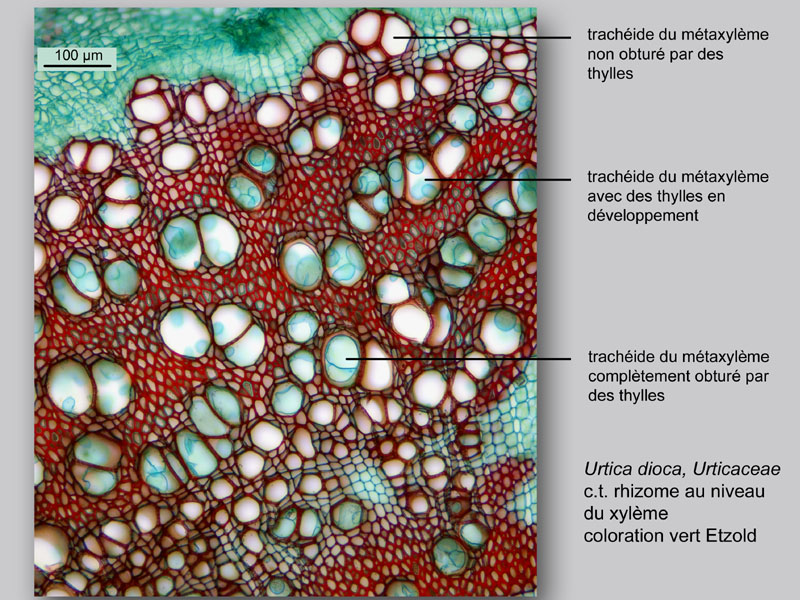 Thylles, tyloses, histologie, histology. #23793