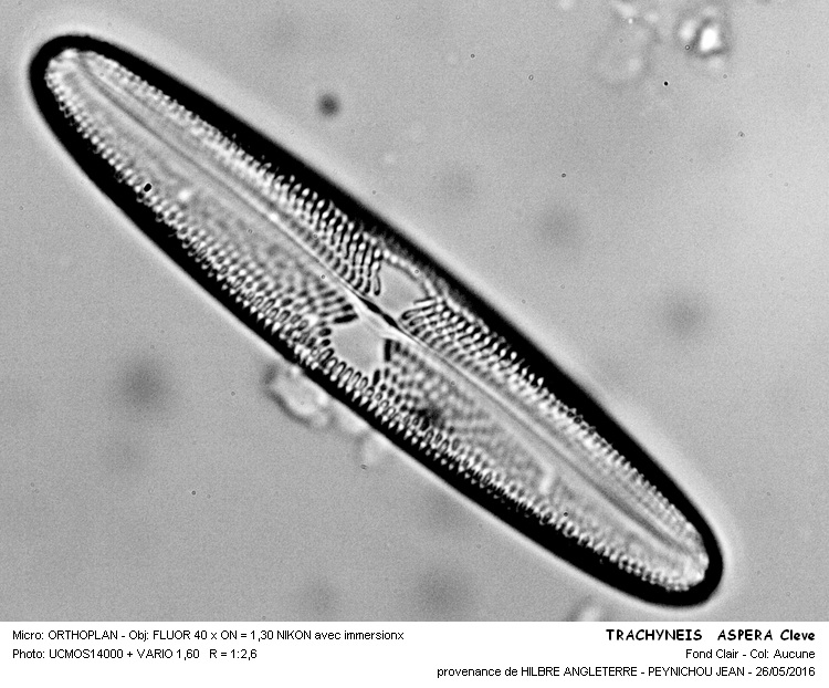 TRACHYNEIS ASPERA Cleve #45385