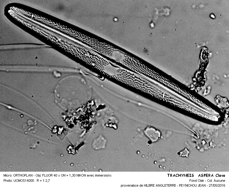 TRACHYNEIS ASPERA Cleve #45407