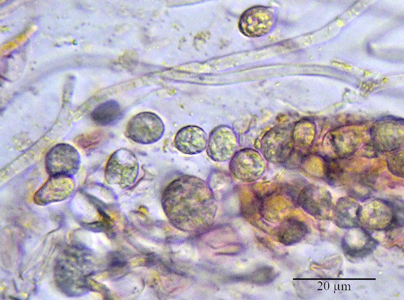 Tremella aurantia #53557