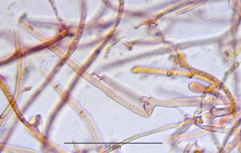 Tremella aurantia #53558