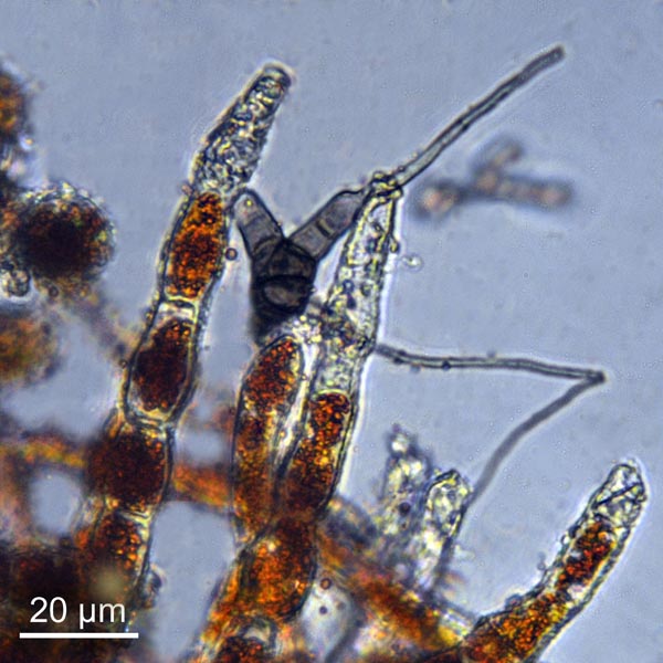Trentepohlia aurea #27827