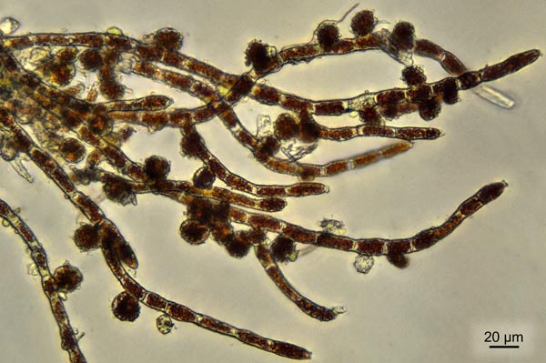 Trentepohlia aurea #27825