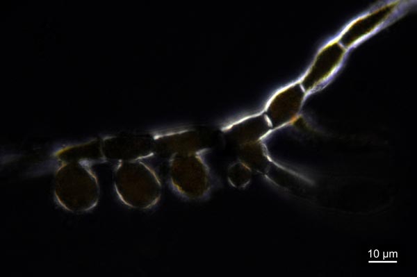 Trentepohlia aurea #27826