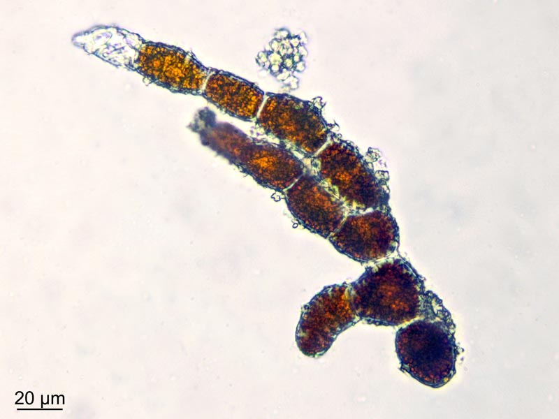 Trentepohlia umbrina (Kütz.) Bornet #49113