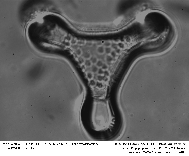 Triceratium  castelliferum Grunow #22283