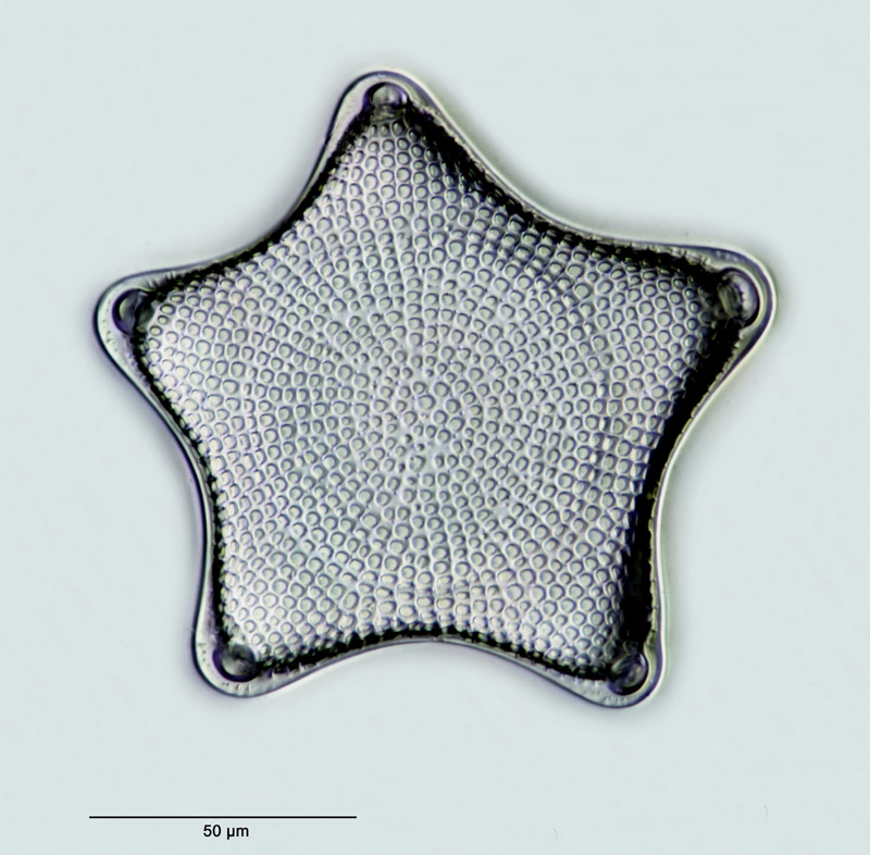 Triceratium antediluvianum (Ehr.) forma pentagona #27651