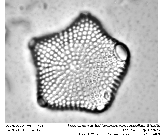 Triceratium antediluvianum var. tessellata Shadb. #12481