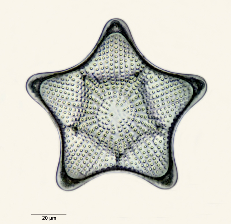 Triceratium balearicum Cleve #27670