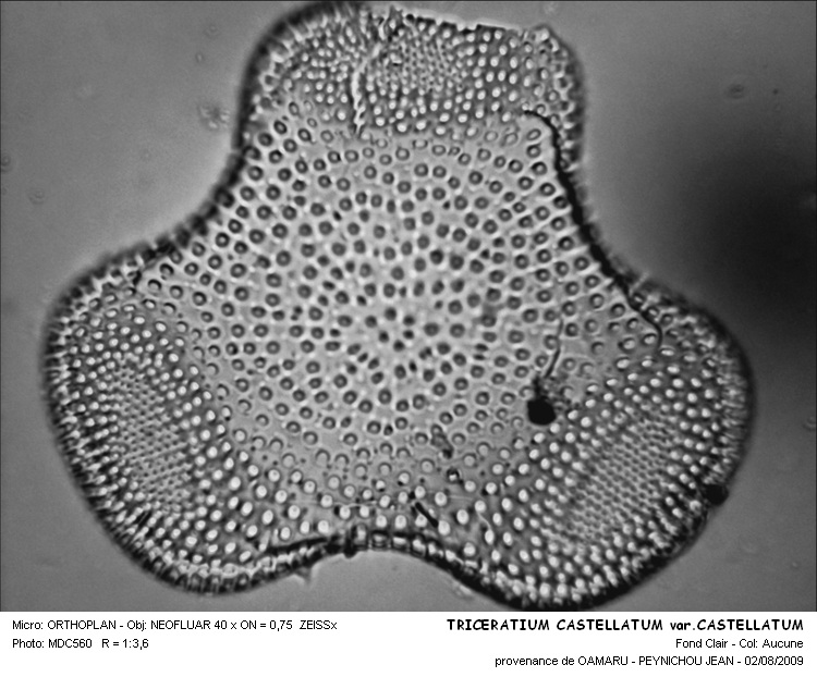Triceratium castellatum var.castellatum et var.fractum #30521