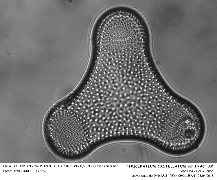 Triceratium castellatum var.castellatum et var.fractum #30522
