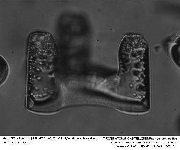 Triceratium Castelliferum #30514