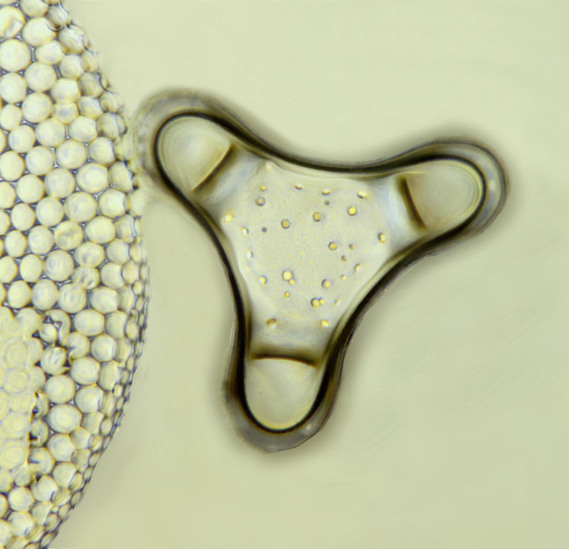 Triceratium castilliferum Grunow #14360