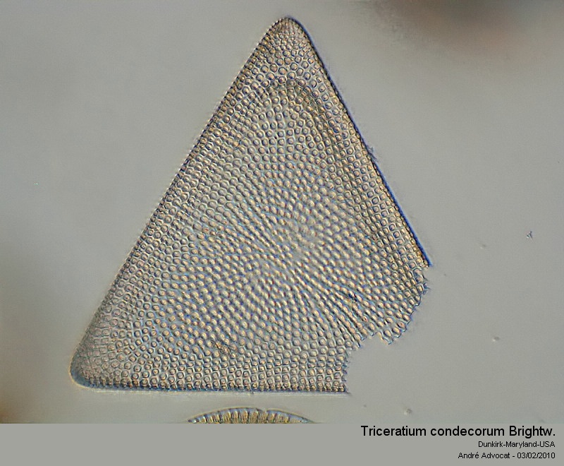 Triceratium condecorum Brightw. #14412