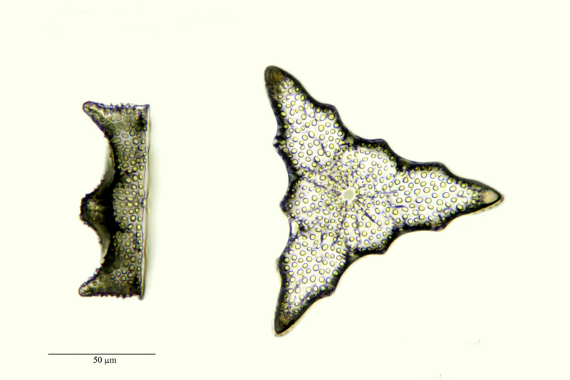 Triceratium crenulatum Gr. & St. #23037