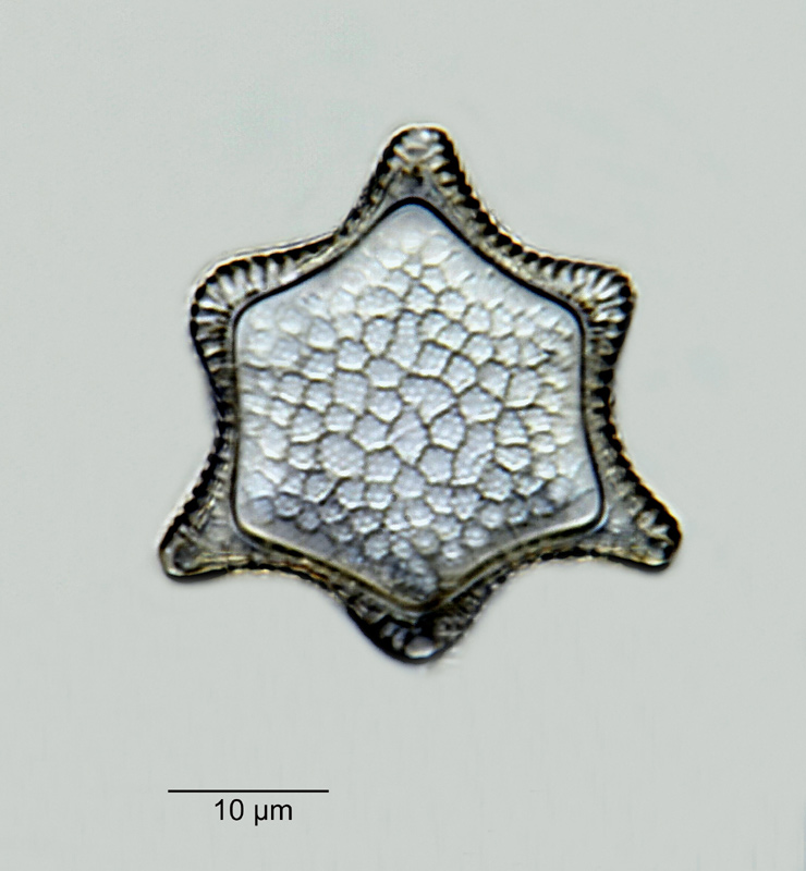 Triceratium dubium Br. #18938
