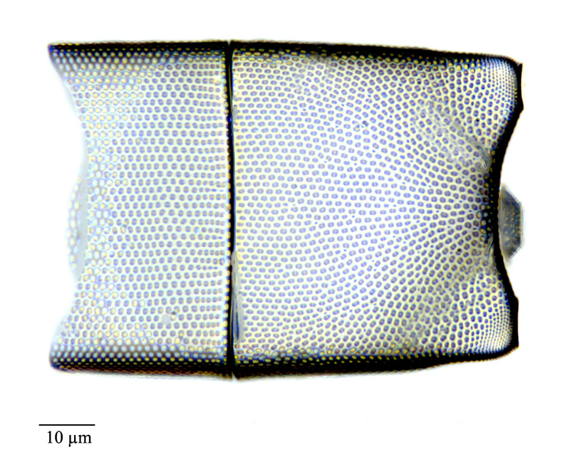 Triceratium elongatum #73808