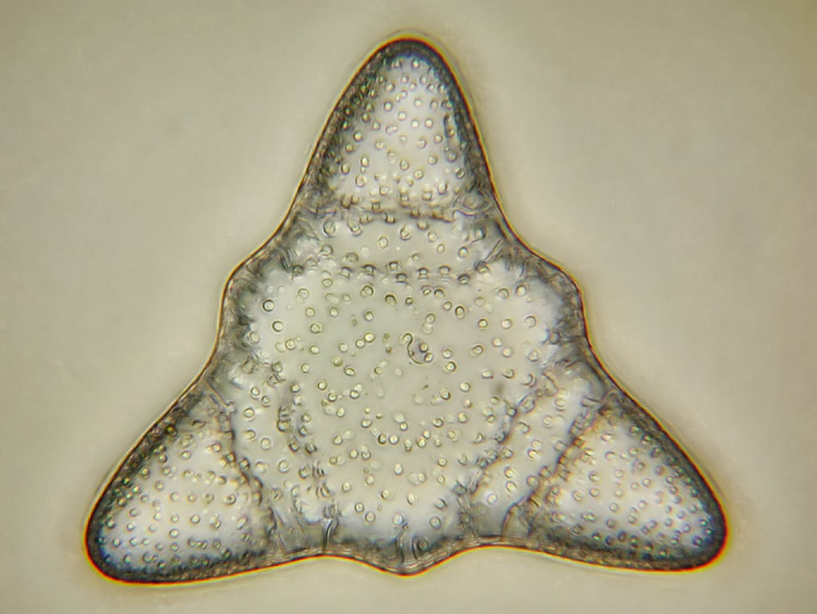 Triceratium flos  Ehrenberg #17457