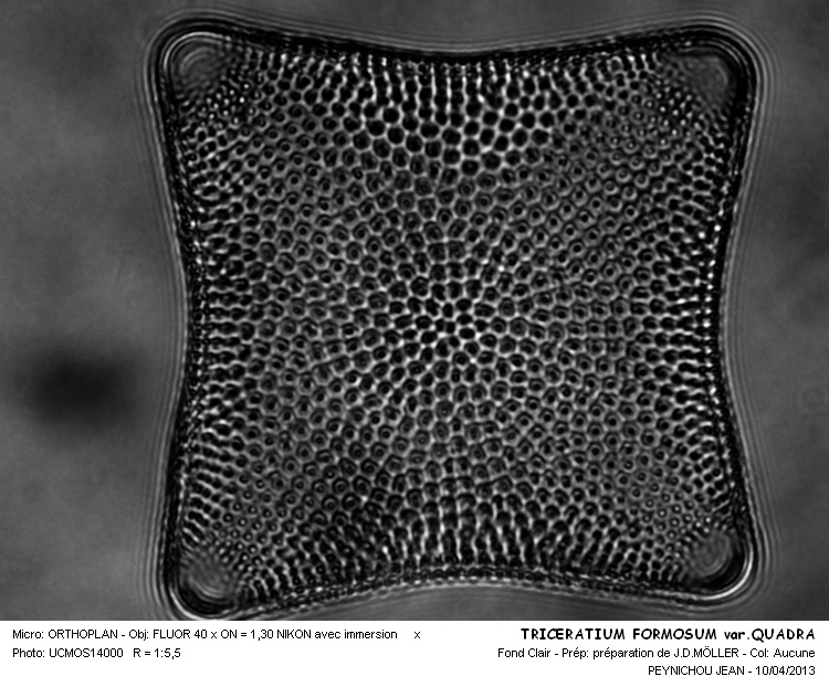Triceratium Formosum var.Quadra #30556