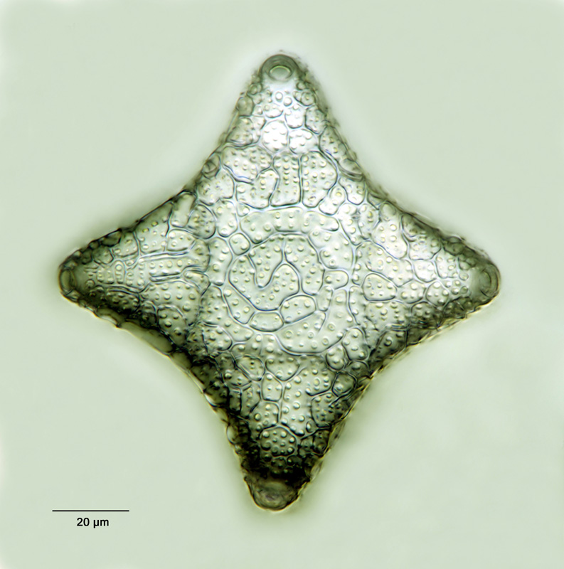 Triceratium junctum Schmidt #15433