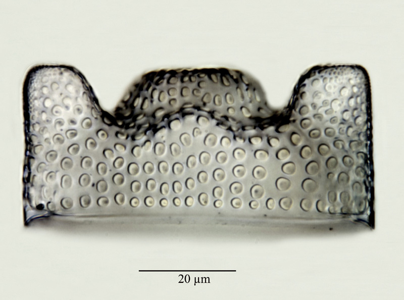 Triceratium nobile Witt #24740