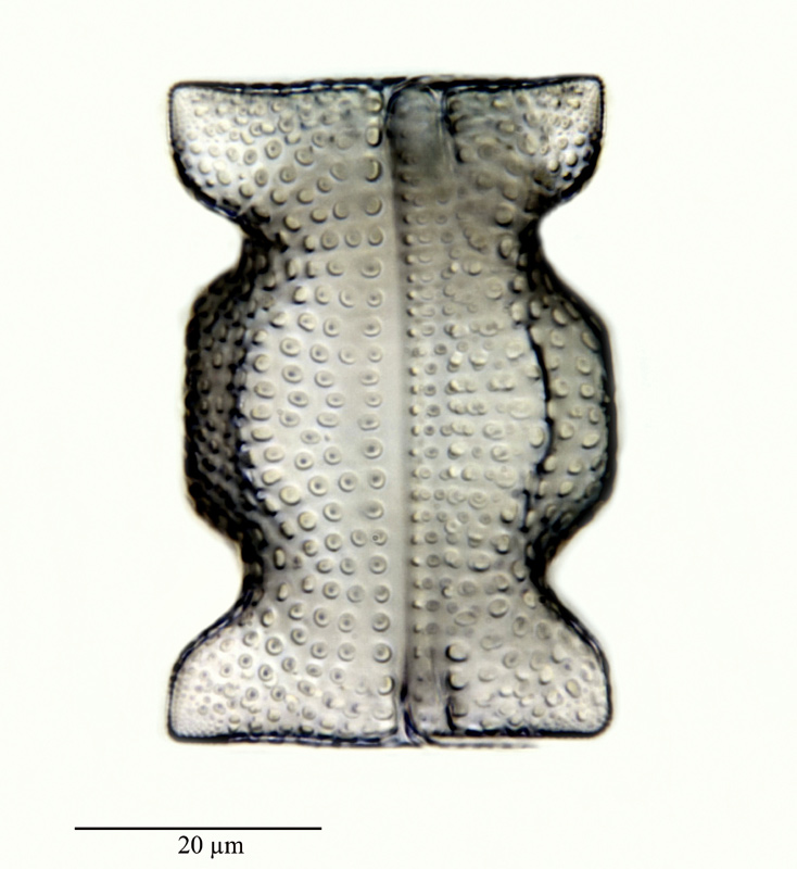 Triceratium nobile Witt #24741