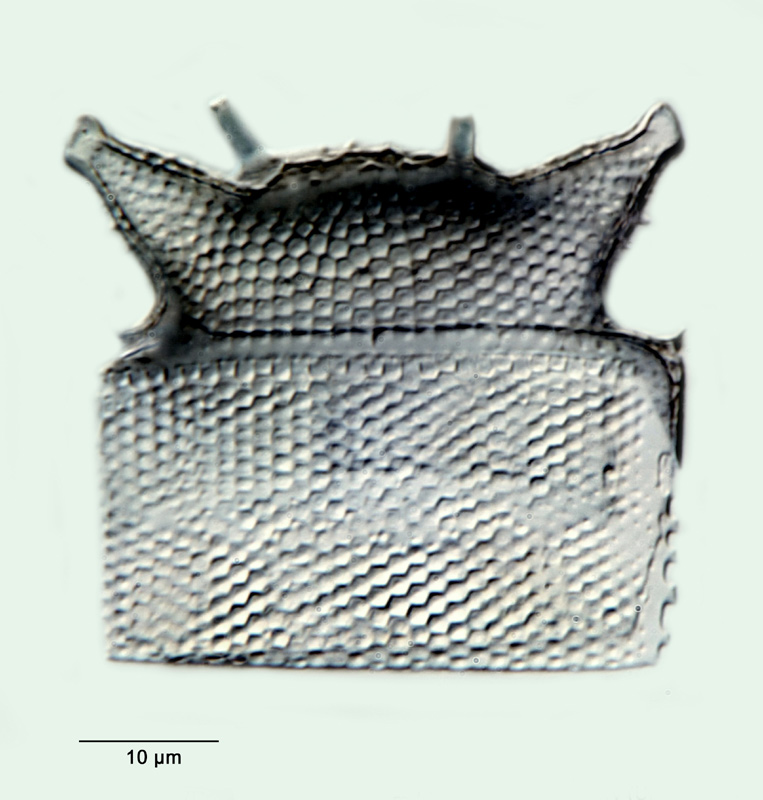 Triceratium pileus Ehr. var. robustior Pant. #31717