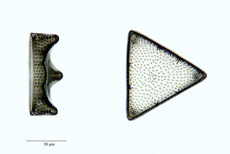 Triceratium pseudonervatum Gr. & St. #22929