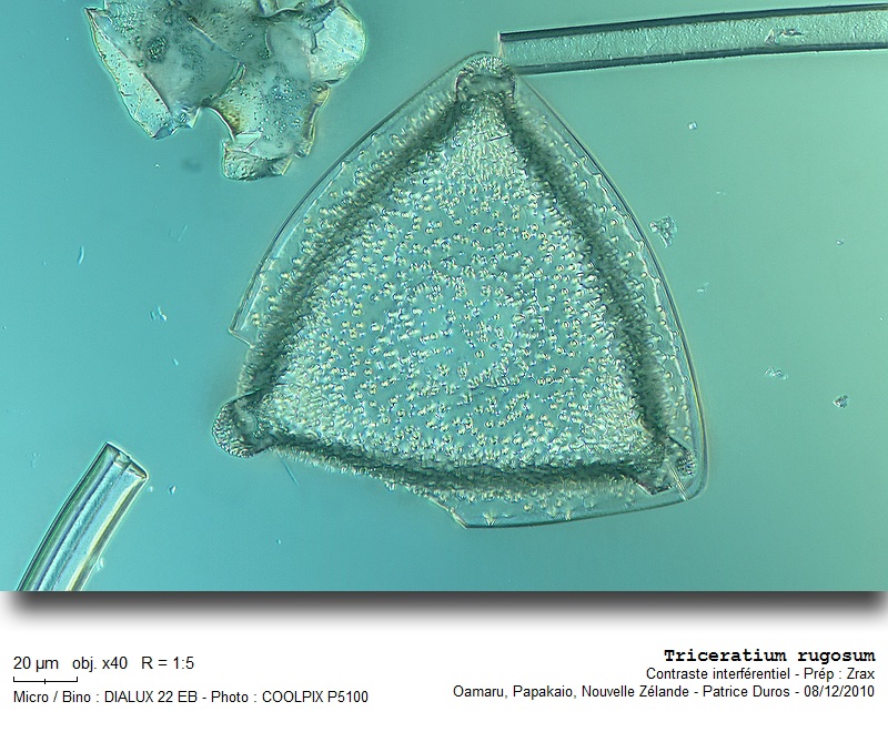 Triceratium rugosum #19515