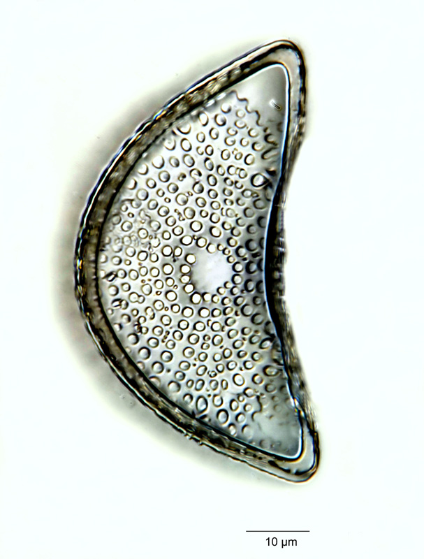 Triceratium semicirculare Brightwell #19373