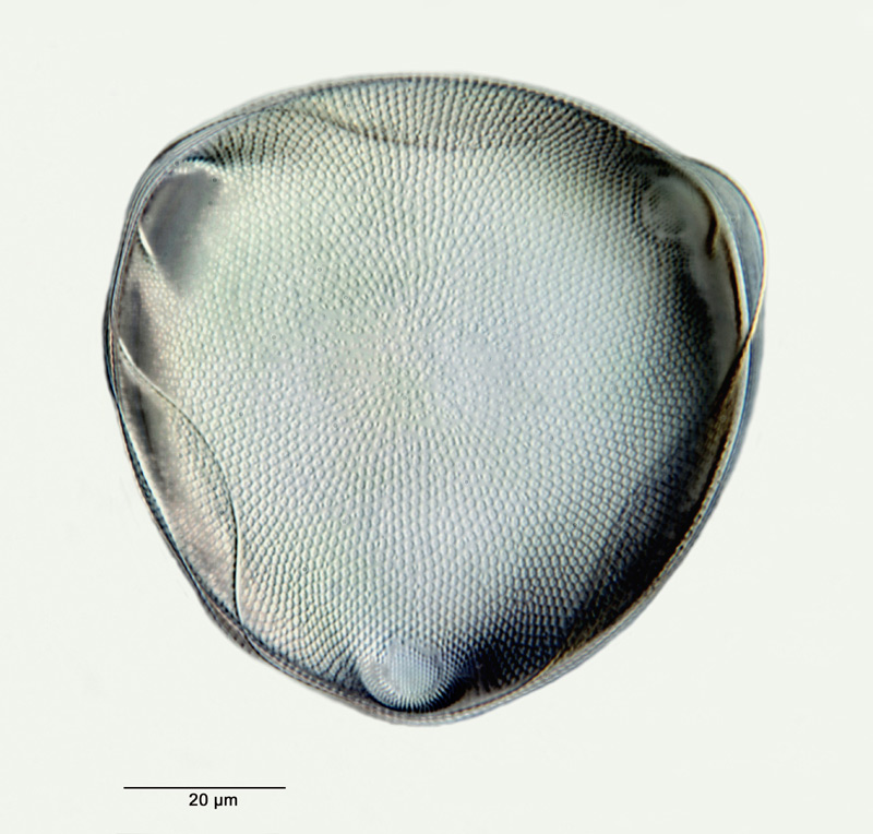 Triceratium shadboltianum Greville #27639