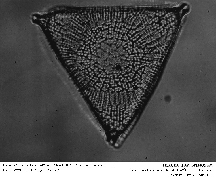 TRICERATIUM SPINOSUM #31501