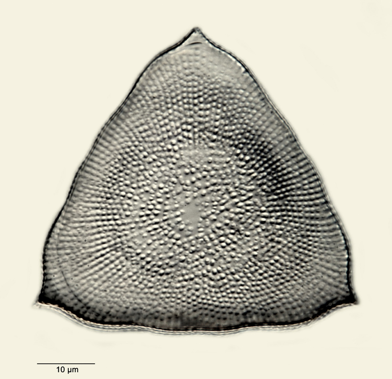Triceratium striolatum Ehrenberg #30632