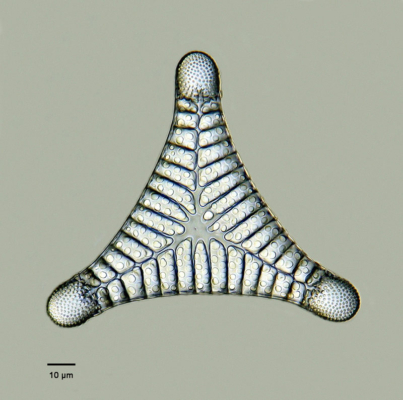 Triceratium venosum #12971