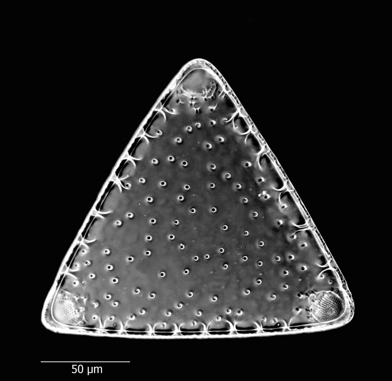 Triceratium venulosum var. major #65952