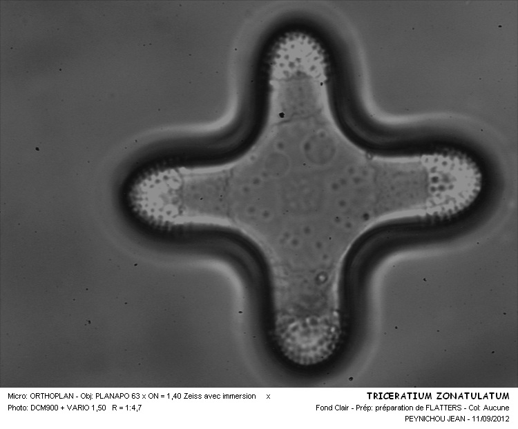 Triceratium zonatulatum Grev. #28224