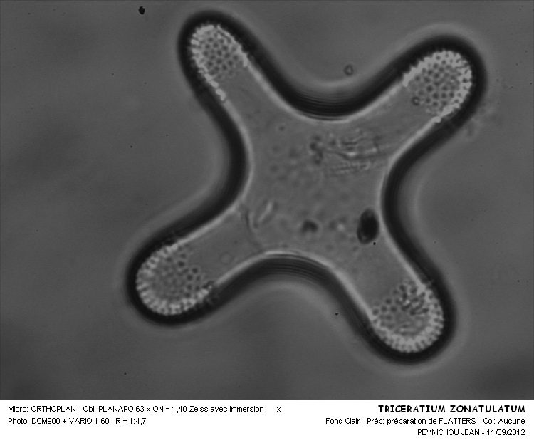 Triceratium zonatulatum Grev. #28223