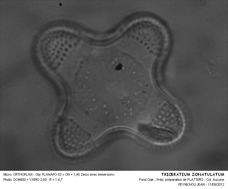 Triceratium zonatulatum Grev. #28222