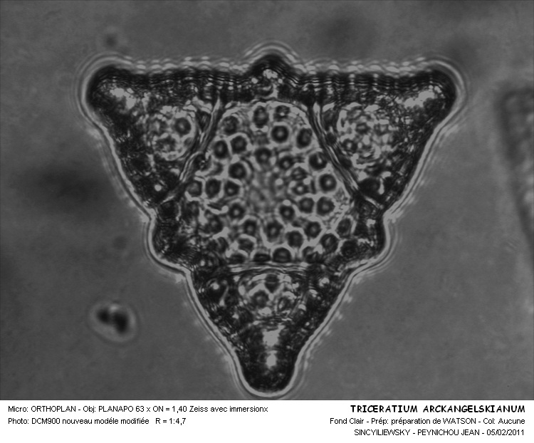 TRICRATIUM ARCKANGELSKIANUM #31537