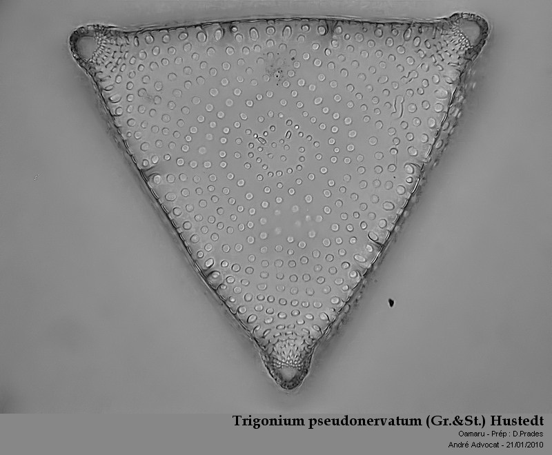 Trigonium pseudonervatum (Gr.&St.) Hustedt #21276