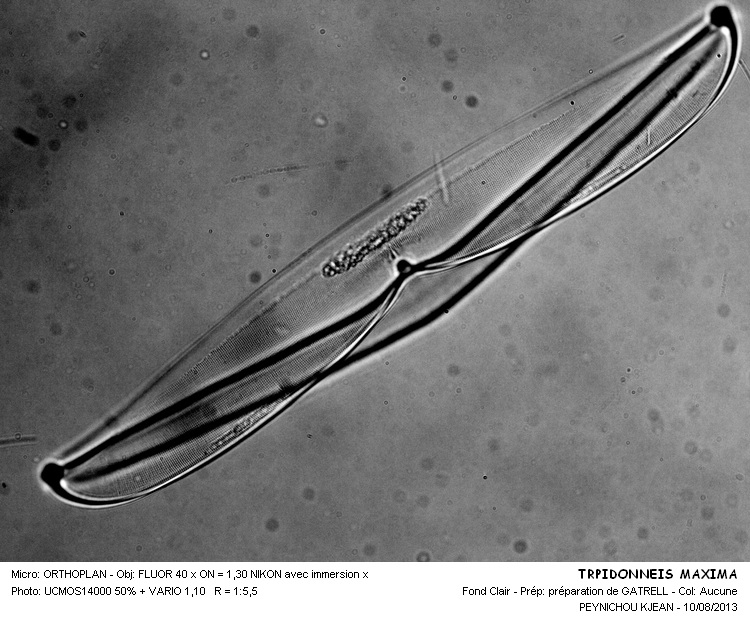 TROPIDONEIS MAXIMA #33214