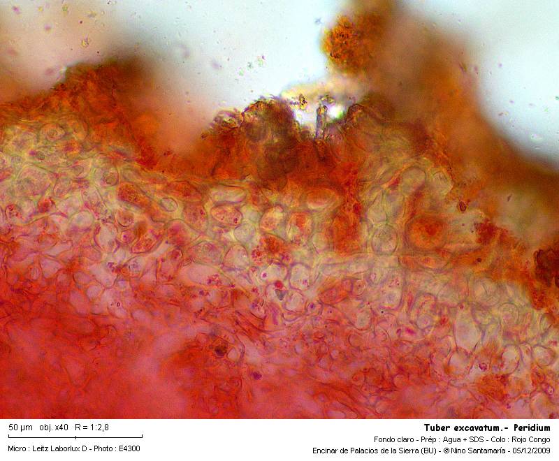 Tuber excavatum #15080