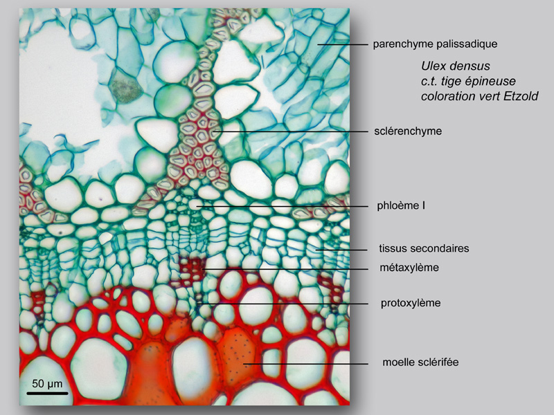 Ulex densus, histologie, histology. #22650