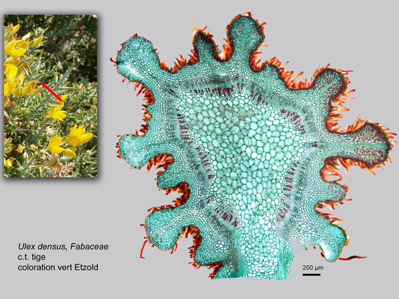 Ulex densus, histologie, histology. #22648